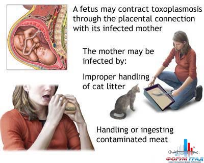токсоплазмоз при беременности