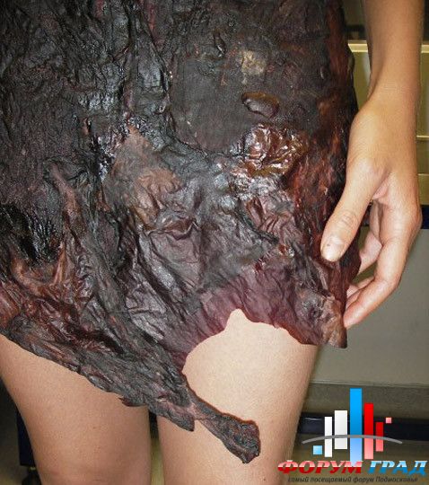 Moda Forum Platie Iz Vina2