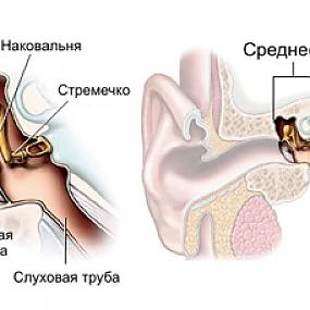 лор-заболевания, виды отитов