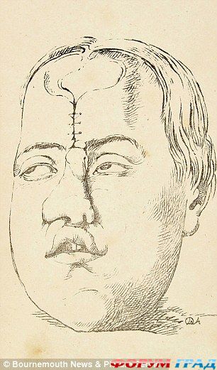 история пластической хирургии